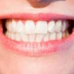 El 70% de los españoles utilizaría ortodoncia para mejorar su sonrisa