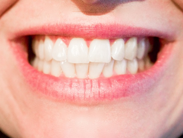 El 70% de los españoles utilizaría ortodoncia para mejorar su sonrisa